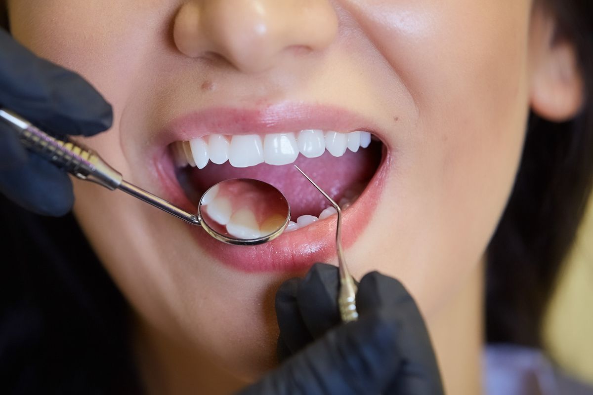 Cosmetic Dentistry Can Fix Chipped, Cracked, or Misshapen Teeth