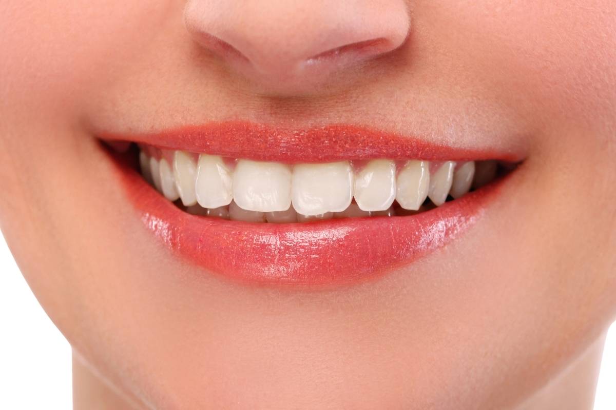 Professional teeth whitening treatment by a cosmetic dentist