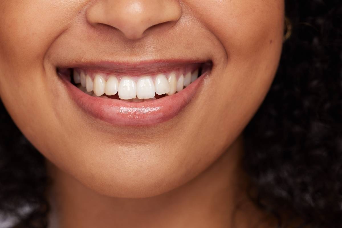 Teeth Whitening Guide: Safe, Fast & Brighter Smiles