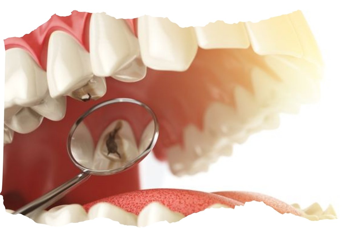 how to know if you have a cavity