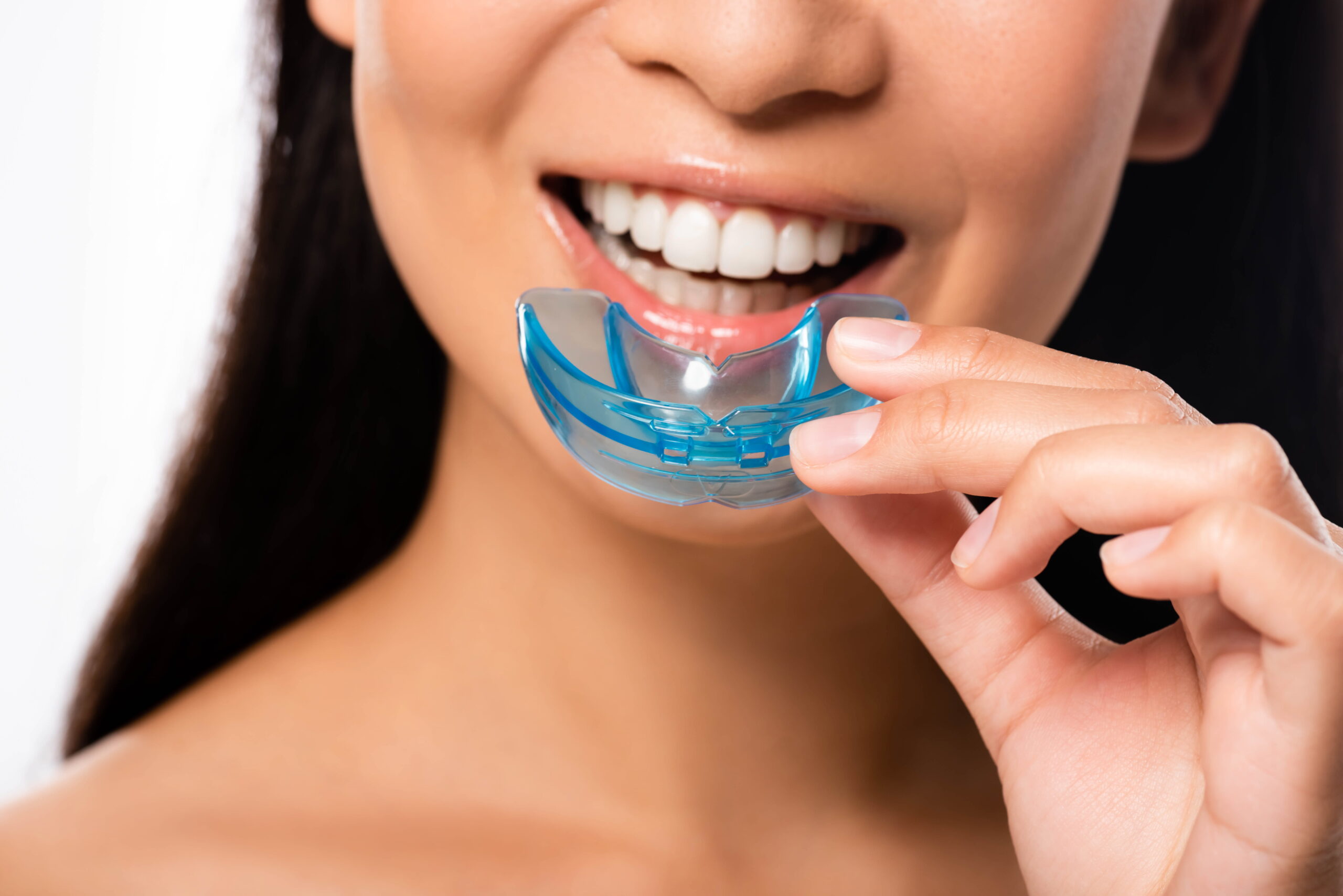 custom mouthguard Chandler